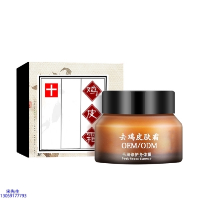 瑞蓝_去鸡皮肤毛刺毛角周滋润修复保湿身体霜